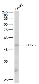 CHST7 Rabbit Polyclonal Antibody