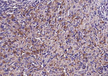 CILP Rabbit Polyclonal Antibody