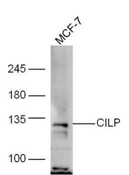 CILP Rabbit Polyclonal Antibody