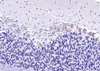 CALB1 Rabbit Polyclonal Antibody