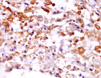 COPZ2 Rabbit Polyclonal Antibody