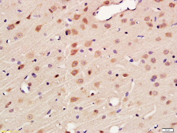 CORD2/OTX3 Rabbit Polyclonal Antibody