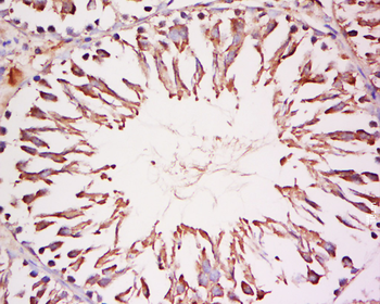 CoREST3 Rabbit Polyclonal Antibody