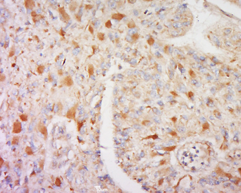 CORO2B Rabbit Polyclonal Antibody