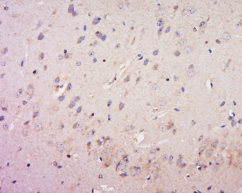 CORO2B Rabbit Polyclonal Antibody