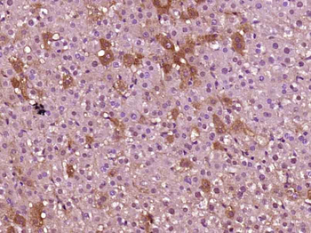 COX18 Rabbit Polyclonal Antibody
