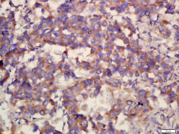 COX6B2 Rabbit Polyclonal Antibody