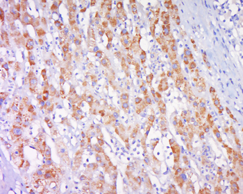 CPNE1 Rabbit Polyclonal Antibody