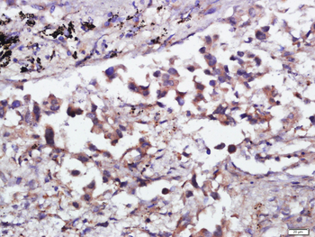 CPNE1 Rabbit Polyclonal Antibody