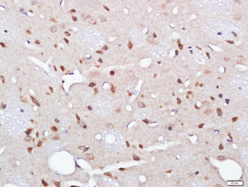 CPNE1 Rabbit Polyclonal Antibody