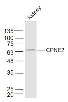 CPNE2 Rabbit Polyclonal Antibody