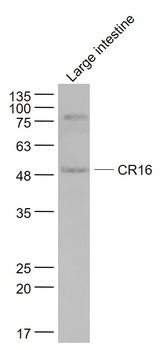 CR16 Rabbit Polyclonal Antibody