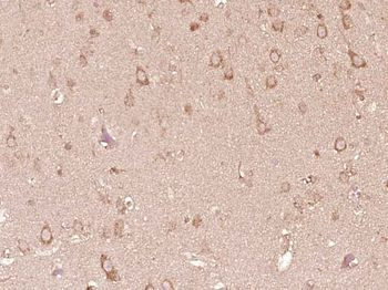 CRB1 Rabbit Polyclonal Antibody
