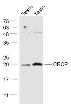 CRCP Rabbit Polyclonal Antibody