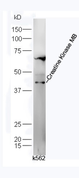 Creatine Kinase MB Rabbit Polyclonal Antibody