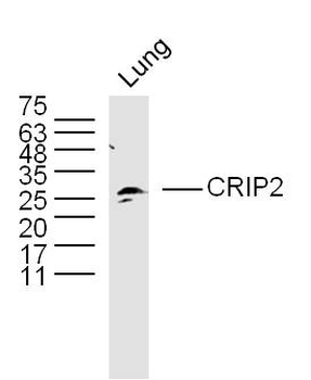 CRIP2 Rabbit Polyclonal Antibody