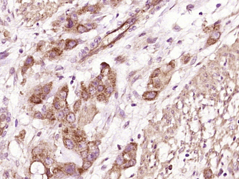 CRISP10 Rabbit Polyclonal Antibody