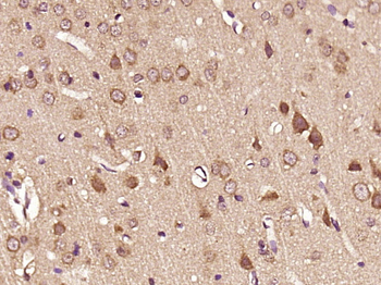 CRISP11 Rabbit Polyclonal Antibody