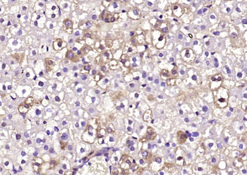 CRLS1 Rabbit Polyclonal Antibody