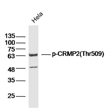 Phospho-CRMP2 (Thr509) Rabbit Polyclonal Antibody