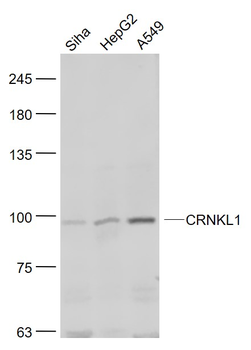 CRNKL1 Rabbit Polyclonal Antibody