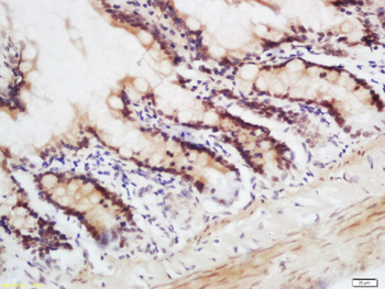 CRNKL1 Rabbit Polyclonal Antibody