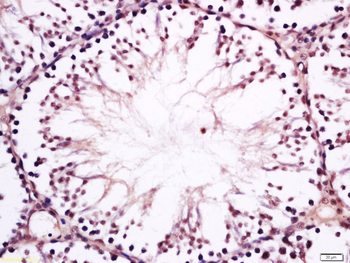 CST11 Rabbit Polyclonal Antibody