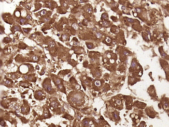 CTRP6 Rabbit Polyclonal Antibody