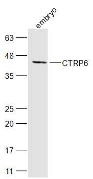 CTRP6 Rabbit Polyclonal Antibody