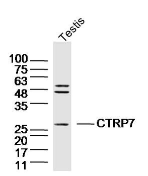 CTRP7 Rabbit Polyclonal Antibody