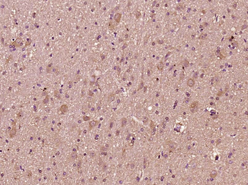 CTTNBP2 Rabbit Polyclonal Antibody