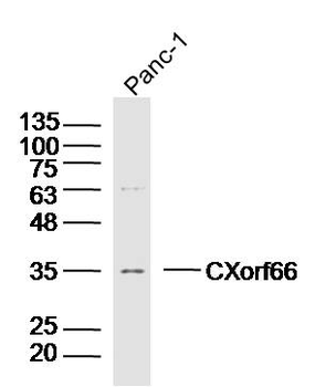 CXorf66 Rabbit Polyclonal Antibody