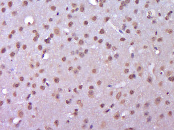CYFIP2 Rabbit Polyclonal Antibody