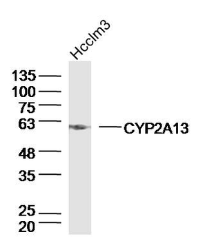 CYP2A13 Rabbit Polyclonal Antibody