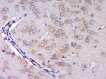 CYP2U1 Rabbit Polyclonal Antibody