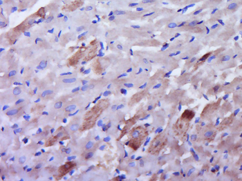 CYP2U1 Rabbit Polyclonal Antibody