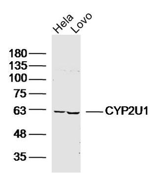 CYP2U1 Rabbit Polyclonal Antibody