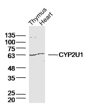 CYP2U1 Rabbit Polyclonal Antibody