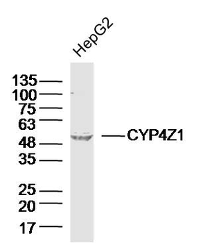 CYP4Z1 Rabbit Polyclonal Antibody