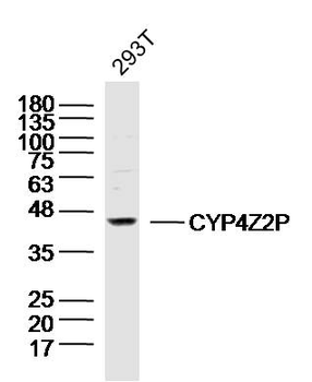 CYP4Z2P Rabbit Polyclonal Antibody
