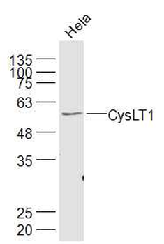 CysLT1 Rabbit Polyclonal Antibody