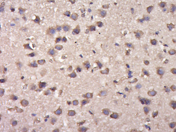 Phospho-delta 1 Catenin (Tyr280) Rabbit Polyclonal Antibody