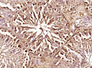 FLIP Rabbit Polyclonal Antibody