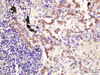 CD361 Rabbit Polyclonal Antibody