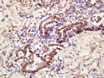 CD361 Rabbit Polyclonal Antibody