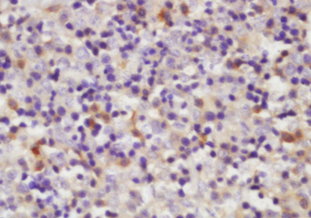 CD361 Rabbit Polyclonal Antibody
