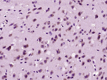 CACNB3 Rabbit Polyclonal Antibody