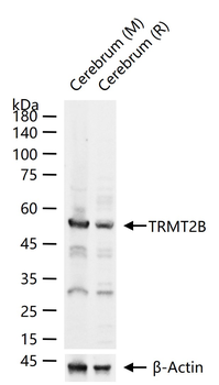 TRMT2B Rabbit Polyclonal Antibody