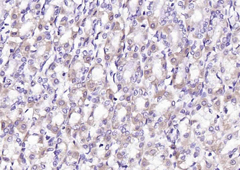 Cytokeratin 3 Rabbit Polyclonal Antibody