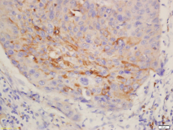 Cytokeratin 3 Rabbit Polyclonal Antibody